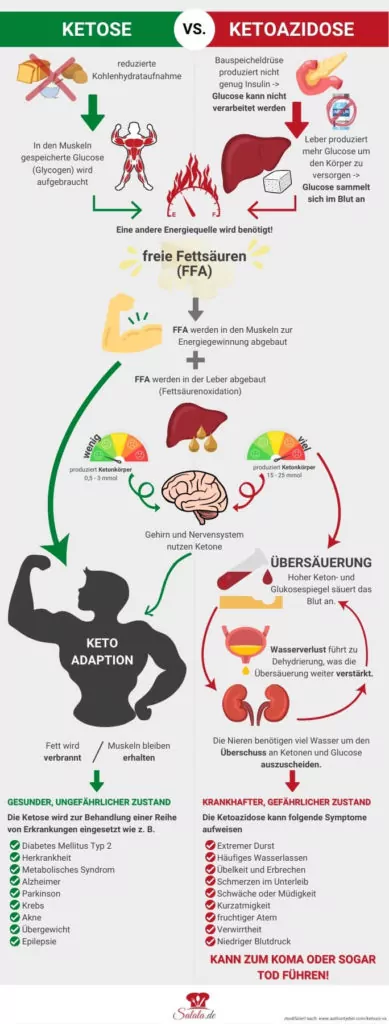 Infografik die den Unterschied zwischen Ketoazidose und der nahrungsinduzierten Ketose als Schaubild darstellt.